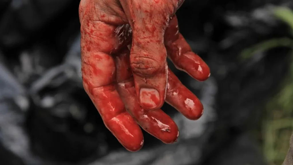 exists bloody hand